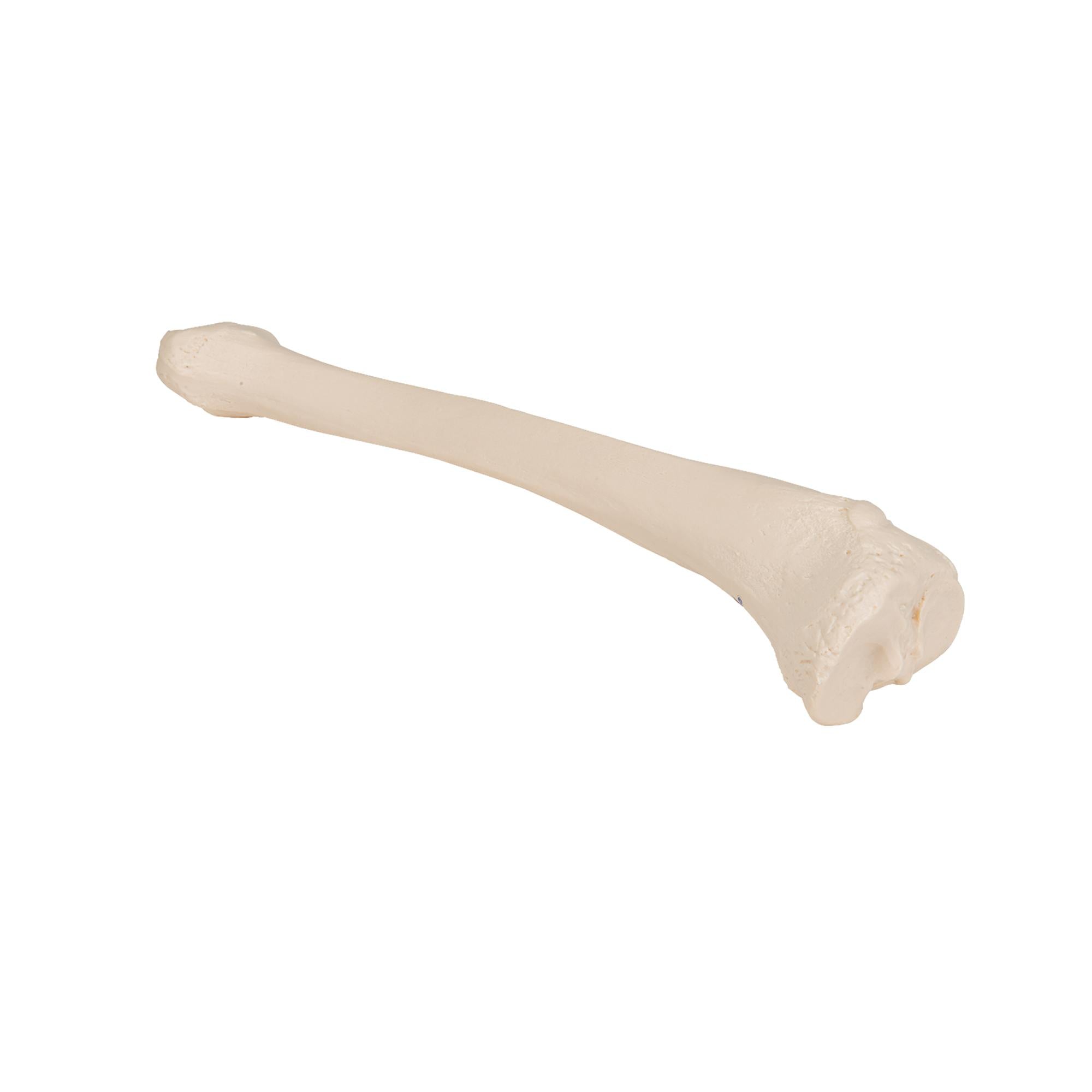 Tibia - Anatomie et pathologie